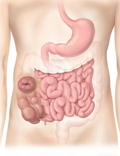Colostom&iacute;a ascendente