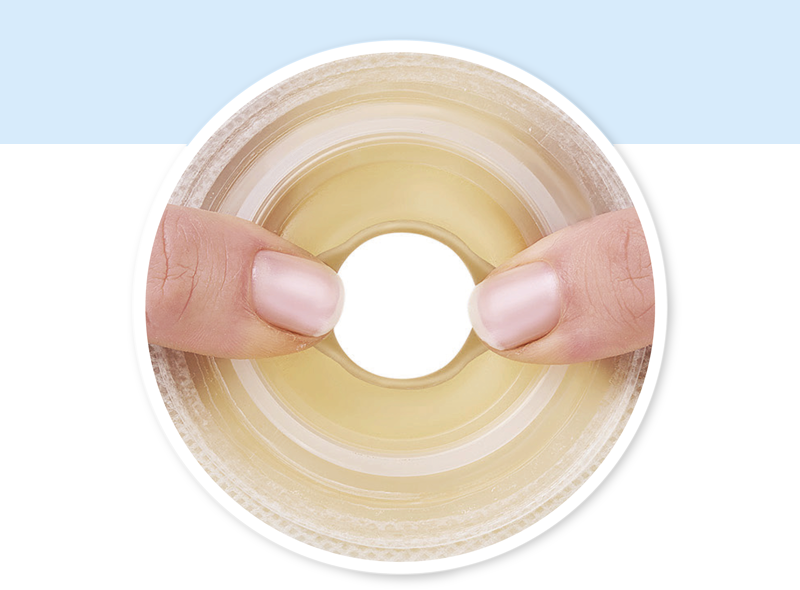 ConvaTec Technologie modellierbar